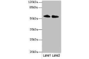 Western blot All lanes: TRIM55 antibody at 1 μg/mL Lane 1: Hela whole cell lysate Lane 2: Mouse liver tissue Secondary Goat polyclonal to rabbit IgG at 1/10000 dilution Predicted band size: 61, 51, 27 kDa Observed band size: 61 kDa (TRIM55 antibody  (AA 101-300))