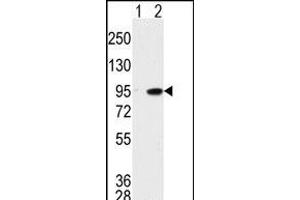 Western blot analysis of K (arrow) using K Antibody (C-term) (ABIN391782 and ABIN2841639). (MAK antibody  (C-Term))