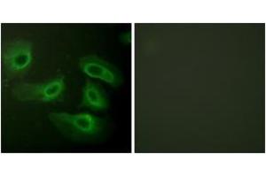 Immunofluorescence analysis of HeLa cells, using Caspase 9 (Ab-196) Antibody. (Caspase 9 antibody  (AA 162-211))