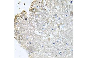 Immunohistochemistry of paraffin-embedded rat brain using CHCHD3 antibody.