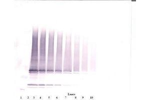 Image no. 1 for anti-Interleukin 17F (IL17F) antibody (ABIN465701) (IL17F antibody)