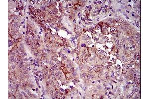 Immunohistochemistry (IHC) image for anti-CD33 (CD33) (AA 15-237) antibody (ABIN1845398) (CD33 antibody  (AA 15-237))