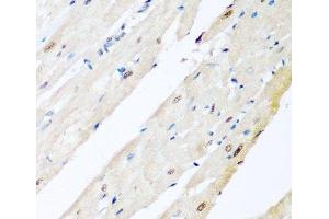 Immunohistochemistry of paraffin-embedded Rat heart using VCP Polyclonal Antibody at dilution of 1:200 (40x lens). (VCP antibody)