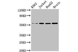 Western Blot Positive WB detected in: K562 whole cell lysate, Jurkat whole cell lysate, HepG2 whole cell lysate, Mouse brain tissue All lanes: SLC16A8 antibody at 3 μg/mL Secondary Goat polyclonal to rabbit IgG at 1/50000 dilution Predicted band size: 53 kDa Observed band size: 53 kDa (MCT3 antibody  (AA 432-504))