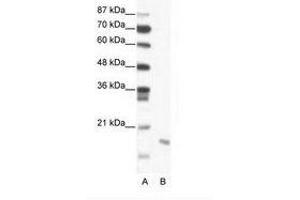 Image no. 1 for anti-Second Mitochondria-Derived Activator of Caspase (DIABLO) (C-Term) antibody (ABIN203000) (DIABLO antibody  (C-Term))