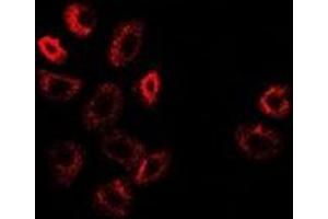 Immunofluorescent analysis of ATF6 staining in A549 cells. (ATF6 antibody)