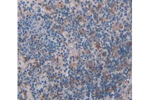 Used in DAB staining on fromalin fixed paraffin- embedded Kidney tissue (ADRBK2 antibody  (AA 191-453))