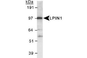 Western blot analysis of LPIN1 in 3T3-L1 lysate using LPIN1 polyclonal antibody . (Lipin 1 antibody  (AA 500-600))