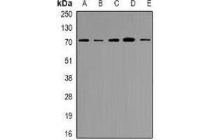 Western blot analysis of NRG1 expression in HEK293T (A), AD293 (B), Hela (C), HepG2 (D), 22RV1 (E) whole cell lysates. (Neuregulin 1 antibody  (N-Term))