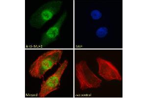 ABIN184792 Immunofluorescence analysis of paraformaldehyde fixed HeLa cells, permeabilized with 0.