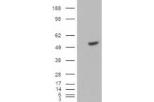 Western Blotting (WB) image for anti-B-Cell Linker (BLNK) (C-Term) antibody (ABIN2465185) (B-Cell Linker antibody  (C-Term))