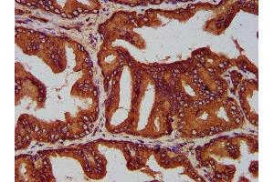 IHC image of ABIN7158397 diluted at 1:200 and staining in paraffin-embedded human prostate tissue performed on a Leica BondTM system.