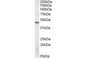 Western Blotting (WB) image for anti-serine/threonine Kinase 17b (STK17B) (AA 316-327) antibody (ABIN490561) (DRAK2 antibody  (AA 316-327))