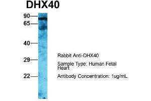 Host: Rabbit  Target Name: DHX40  Sample Tissue: Human Fetal Heart  Antibody Dilution: 1.