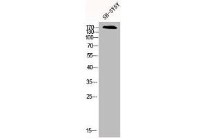 Western Blot analysis of SH-SY5Y cells using CFTR Polyclonal Antibody (CFTR antibody)