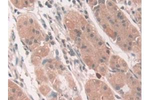 Immunohistochemistry (IHC) image for anti-ATPase, Cu++ Transporting, beta Polypeptide (ATP7B) (AA 59-426) antibody (ABIN7441340)