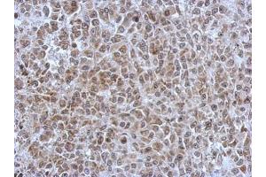 IHC-P Image Immunohistochemical analysis of paraffin-embedded HBL435 xenograft, using POM121, antibody at 1:500 dilution. (POM121 antibody  (N-Term))