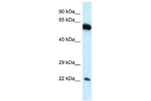 Western Blot showing NICN1 antibody used at a concentration of 1.