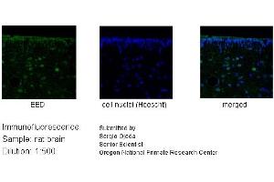 Sample Type :  Rat Brain lysate   Dilution:   1:500