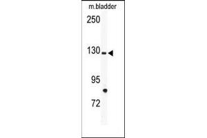 Image no. 1 for anti-tyrosine Kinase with Immunoglobulin-Like and EGF-Like Domains 1 (TIE1) (N-Term) antibody (ABIN359947) (TIE1 antibody  (N-Term))