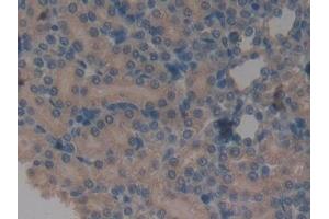 Detection of a1BG in Rat Kidney Tissue using Monoclonal Antibody to Alpha-1-B-Glycoprotein (a1BG) (A1BG antibody  (AA 220-415))