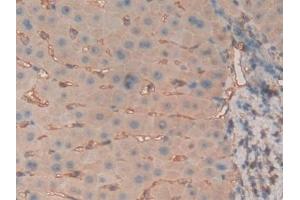 Immunohistochemistry (IHC) image for anti-beta-2-Microglobulin (B2M) (AA 22-119) antibody (ABIN7429220)