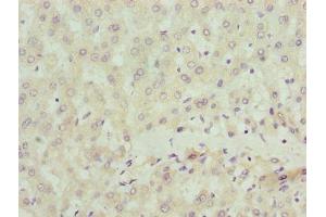 Immunohistochemistry of paraffin-embedded human liver tissue using ABIN7169907 at dilution of 1:100 (Sclt1 antibody  (AA 1-79))