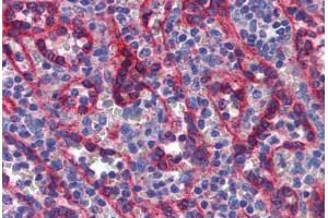 Human Spleen: Formalin-Fixed, Paraffin-Embedded (FFPE) (T-Box 18 antibody  (AA 421-470))