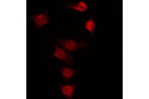 Immunofluorescence (fixed cells) (IF/ICC) image for anti-Nitric Oxide Synthase 3 (Endothelial Cell) (NOS3) (pSer615) antibody (ABIN6255425)