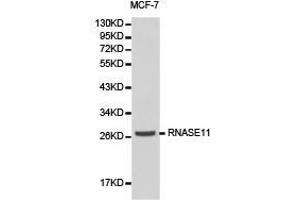 Western Blotting (WB) image for anti-Ribonuclease, RNase A Family, 11 (Non-Active) (RNASE11) antibody (ABIN1874613)