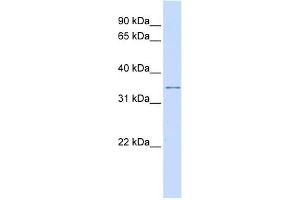 KCNRG antibody used at 1 ug/ml to detect target protein. (KCNRG antibody  (Middle Region))
