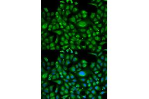 Immunofluorescence analysis of U2OS cell using HSPA1L antibody. (HSPA1L antibody)