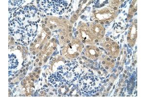 GPT antibody was used for immunohistochemistry at a concentration of 4-8 ug/ml to stain Epithelial cells of renal tubule (arrows) in Human Kidney.