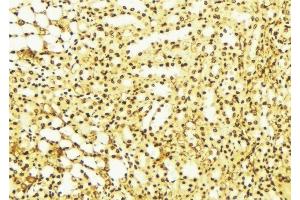 ABIN6275841 at 1/100 staining Mouse liver tissue by IHC-P. (DRAK2 antibody  (C-Term))