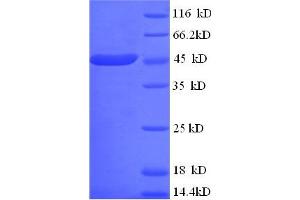 SDS-PAGE (SDS) image for Creatine Kinase, Mitochondrial 1A (CKMT1A) (AA 40-417) protein (His tag) (ABIN5712708) (CKMT1A Protein (AA 40-417) (His tag))