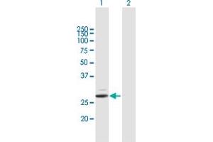 Western Blot analysis of PRSS2 expression in transfected 293T cell line by PRSS2 MaxPab polyclonal antibody. (PRSS2 antibody  (AA 1-239))