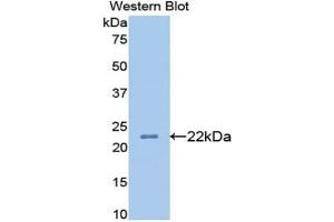 Detection of Recombinant APOB, Rat using Monoclonal Antibody to Apolipoprotein B (APOB) (APOB antibody  (AA 2747-2913))