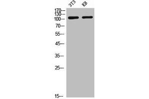Western Blot analysis of NIH-3T3 KB cells using CD21 Polyclonal Antibody (CD21 antibody  (Internal Region))