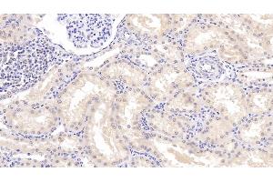 Detection of SOD3 in Human Kidney Tissue using Monoclonal Antibody to Superoxide Dismutase 3, Extracellular (SOD3) (SOD3 antibody  (AA 19-240))