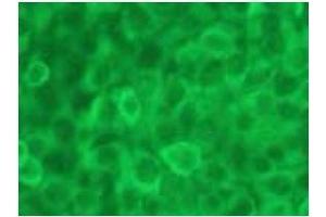Immunofluorescence (IF) image for anti-Caspase 12 (Gene/pseudogene) (CASP12) (AA 95-318), (N-Term) antibody (ABIN567795) (Caspase 12 antibody  (N-Term))