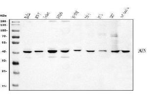 Western blot analysis of DHPS/DHS using anti-DHPS/DHS antibody (ABIN7601998).