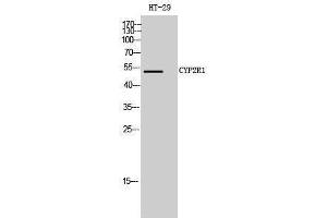 Western Blotting (WB) image for anti-Cytochrome P450, Family 2, Subfamily R, Polypeptide 1 (CYP2R1) (Internal Region) antibody (ABIN3184189) (CYP2R1 antibody  (Internal Region))