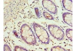 Immunohistochemistry of paraffin-embedded human colon tissue using ABIN7143353 at dilution of 1:100 (ADSS antibody  (AA 1-280))