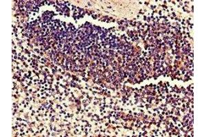 Immunohistochemistry of paraffin-embedded human spleen tissue using ABIN7174759 at dilution of 1:100 (C17orf78 antibody  (AA 1-186))