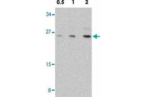 Western blot analysis of NOL3 in mouse muscle tissue lysate with NOL3 polyclonal antibody  at 0. (NOL3 antibody  (C-Term))