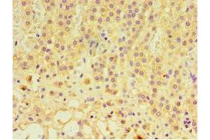 Immunohistochemistry of paraffin-embedded human adrenal gland tissue using ABIN7153805 at dilution of 1:100 (GTF2H2C antibody  (AA 1-260))