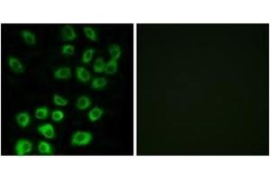 Immunofluorescence analysis of MCF7 cells, using ARFGAP1 Antibody. (ARFGAP1 antibody  (AA 171-220))