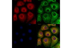 ABIN6260109 and ABIN6278114 staining Hela cells by IF/ICC.