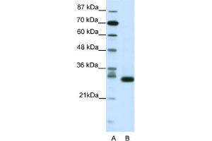 WB Suggested Anti-CDK5 Antibody Titration:  1. (CDK5 antibody  (N-Term))