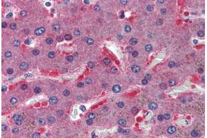 Human Liver: Formalin-Fixed, Paraffin-Embedded (FFPE) (CBS antibody  (AA 1-101))